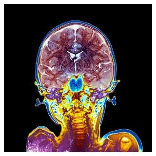 Mri Posters & Prints