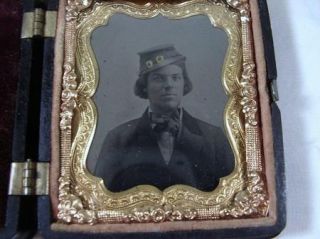 Civil War Era Cased Suited Man in Kepi