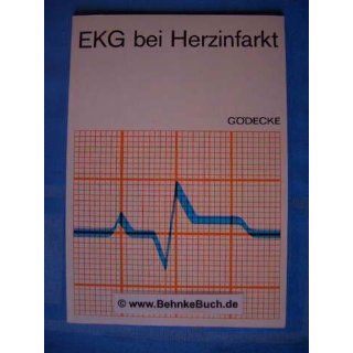 EKG bei Herzinfarkt. Christoph Büchner Bücher